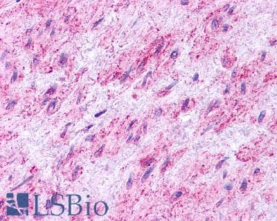PathPlus™ EDNRB / Endothelin B Receptor Antibody (N-Terminus)