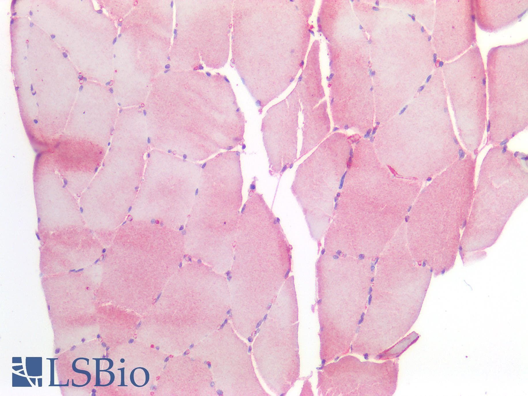 IHC-plus™ HSPB1 / HSP27 Antibody