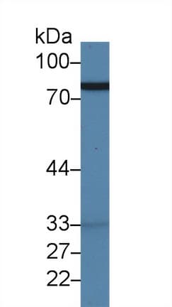 LF / LTF / Lactoferrin Antibody (aa25-352)