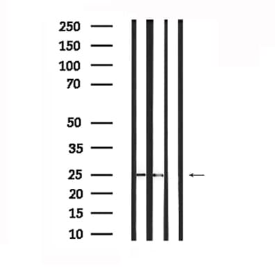 SOCS3 Antibody