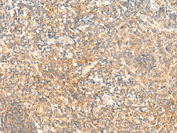 C1qRP / CD93 Antibody