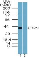 Polyclonal Rabbit anti-Human SOX1 Antibody (aa100-150, WB)