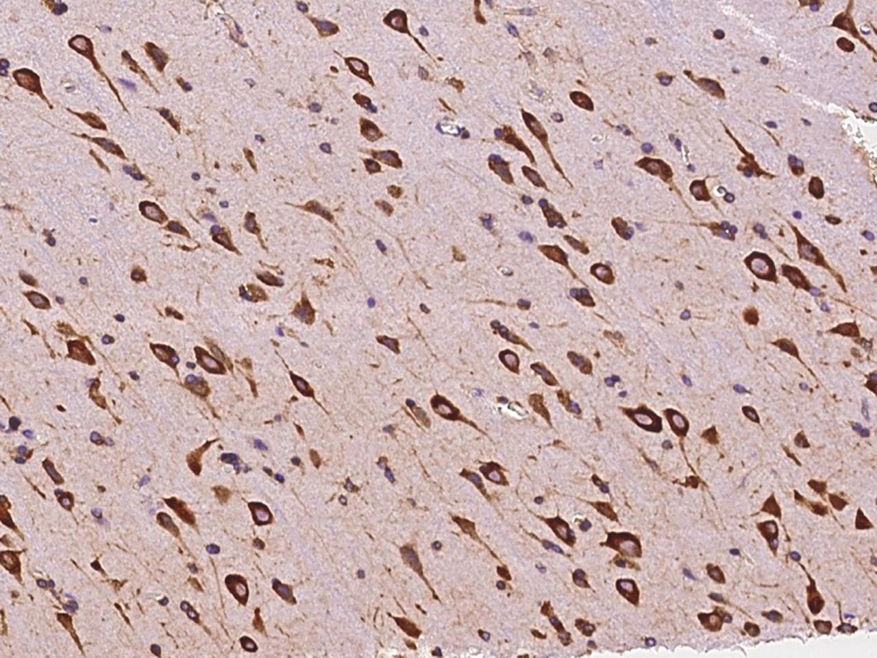 AIMP1 / EMAP II Antibody (Preservative Free)