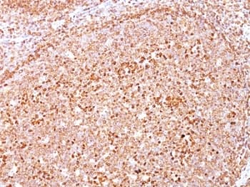 CD79A / CD79 Alpha Antibody (aa202-216, clone SPM550)