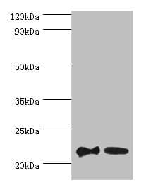 SRI / Sorcin Antibody (aa1-198)