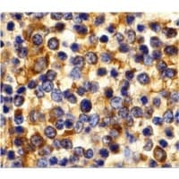 Polyclonal Rabbit anti-Human CCR3 Antibody (IHC, IF, WB)