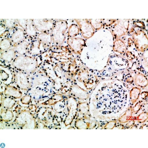 CD16 Antibody