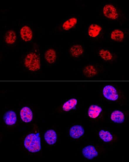 TP53 / p53 Antibody