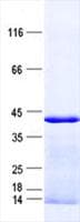 Human AKR1B15 Protein (Recombinant His, N-Terminal)