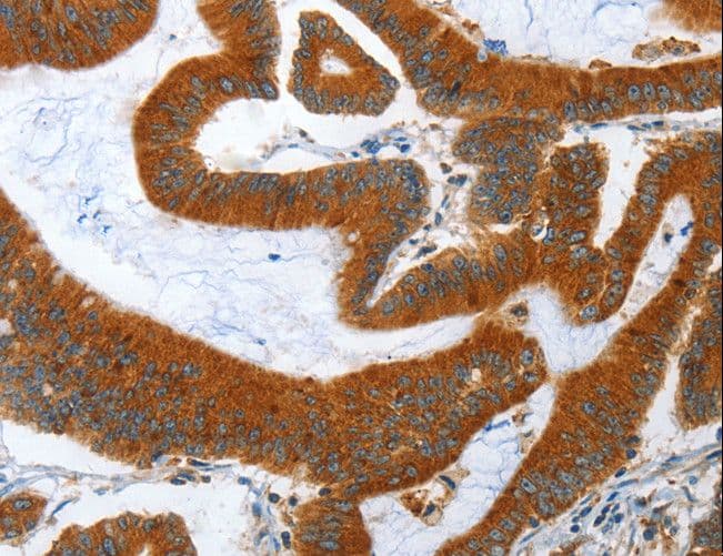 ANAPC10 / APC10 Antibody