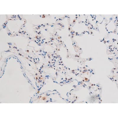 STAT3 Antibody (phospho-Ser727)