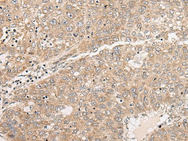 C1orf101 Antibody