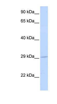 SLC25A6 / ANT3 Antibody (aa36-85)