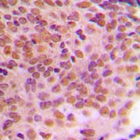 Polyclonal Rabbit anti-Human CCNB1 / Cyclin B1 Antibody (phospho-Ser126, IHC, WB)