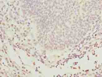 GLT1D1 Antibody