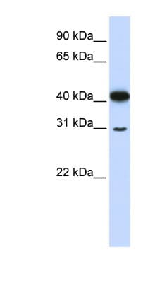 Polyclonal Rabbit anti-Human OVOL2 Antibody (N-Terminus, WB)