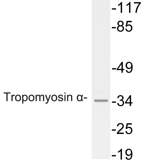 TPM1 / Tropomyosin Antibody (aa40-89)