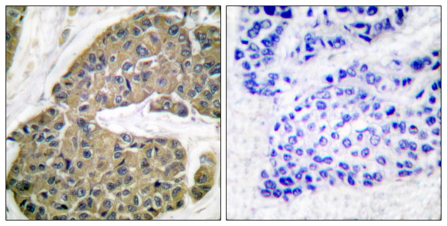 Polyclonal Rabbit anti-Human KRT5 / CK5 / Cytokeratin 5 Antibody (IHC, WB)