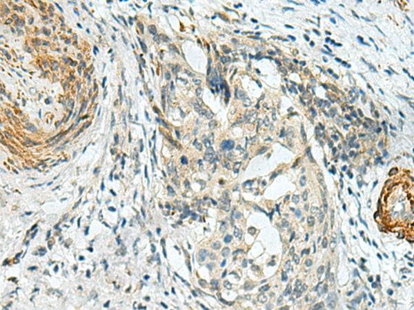 Polyclonal Rabbit anti-Human LPPR5 Antibody (IHC, WB)