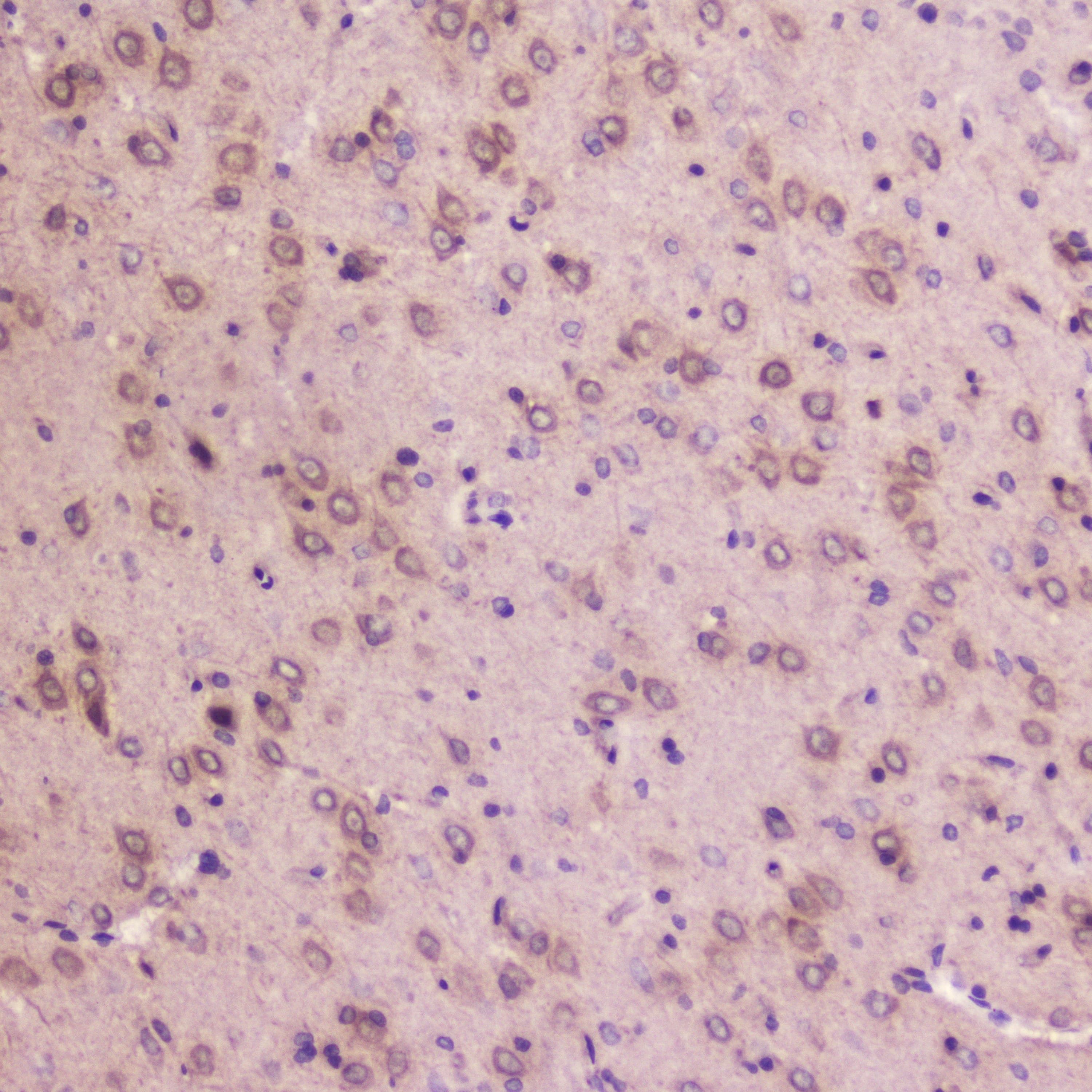 IGFBP2 / IGF-BP53 Antibody