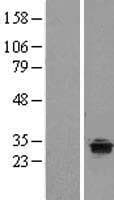 TPRG1 Protein (Over-Expression Lysate Myc-DDK (Flag))