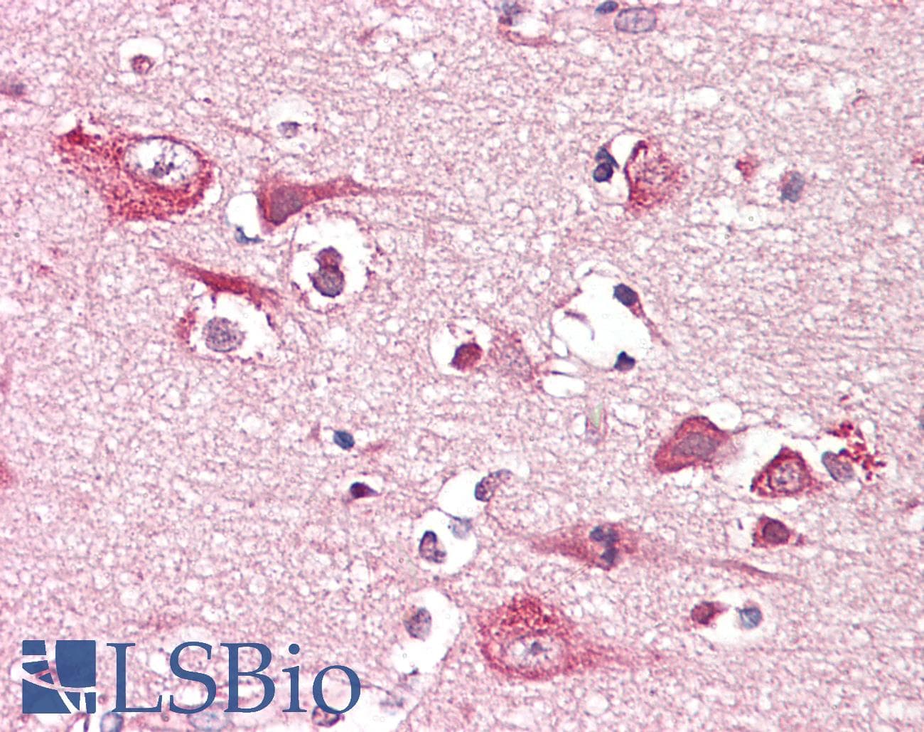 IHC-plus™ Monoclonal Mouse anti-Human PLCG1 Antibody (clone 2B1, IHC, WB)