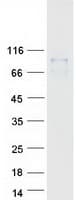 Human CCDC157 Protein (Recombinant Myc-DDK (Flag))