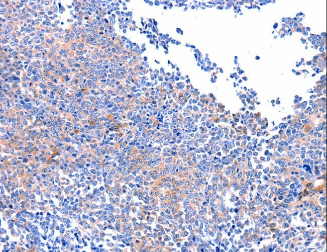 Polyclonal Rabbit anti-Human FAK / Focal Adhesion Kinase Antibody (IHC, WB)