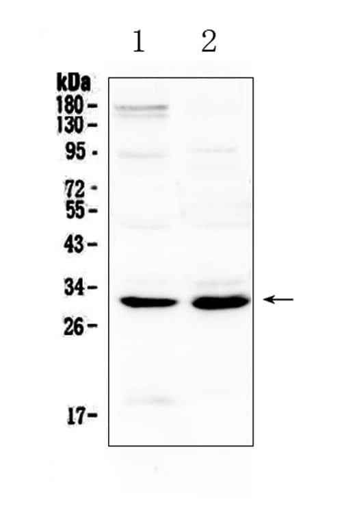 IL-1B / IL-1 Beta Antibody