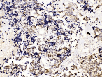 TERF2 / TRF2 Antibody
