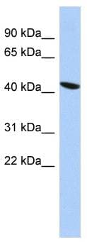 Polyclonal Rabbit anti-Human ZNF71 Antibody (C-Terminus, IHC, WB)