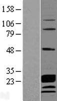 CCDC115 Protein (Over-Expression Lysate Myc-DDK (Flag))