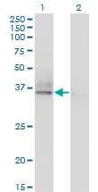 ASGR2 Antibody (clone 1D7)