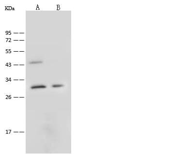 C1QTNF6 / CTRP6 Antibody