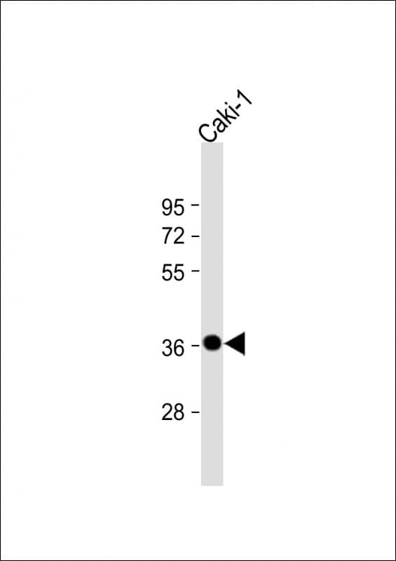 CARP / ANKRD1 Antibody (N-Terminus)