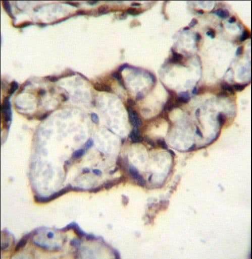 Polyclonal Rabbit anti-Human PLCXD2 Antibody (aa99-127, IHC, WB)
