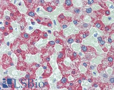 IHC-plus™ ALDH2 Antibody (41-90 aa, N-terminal)
