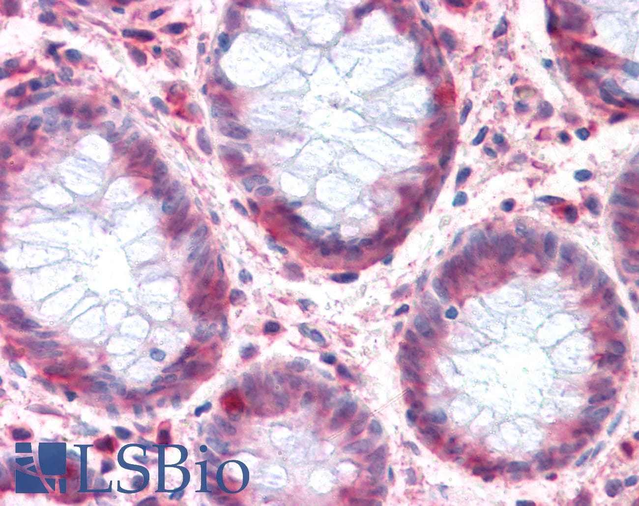 IHC-plus™ SLC1A4 / ASCT1 Antibody (C-Terminus)