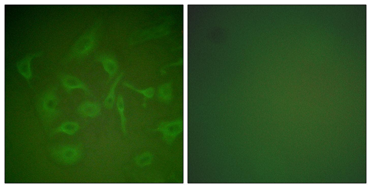 SCGB2A2 / Mammaglobin A Antibody