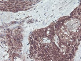 IRF6 Antibody (clone OTI2C10, Carrier-free)