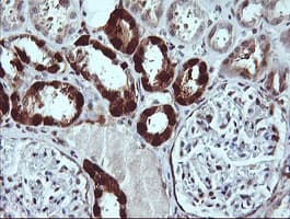 LGALS3 / Galectin 3 Antibody (clone OTI1A2)