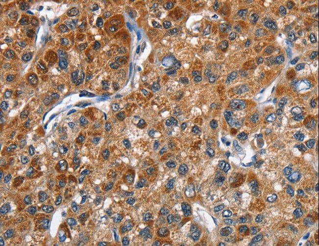 STK17B / DRAK2 Antibody