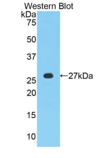 MPZ / P0 Antibody (aa30-248)