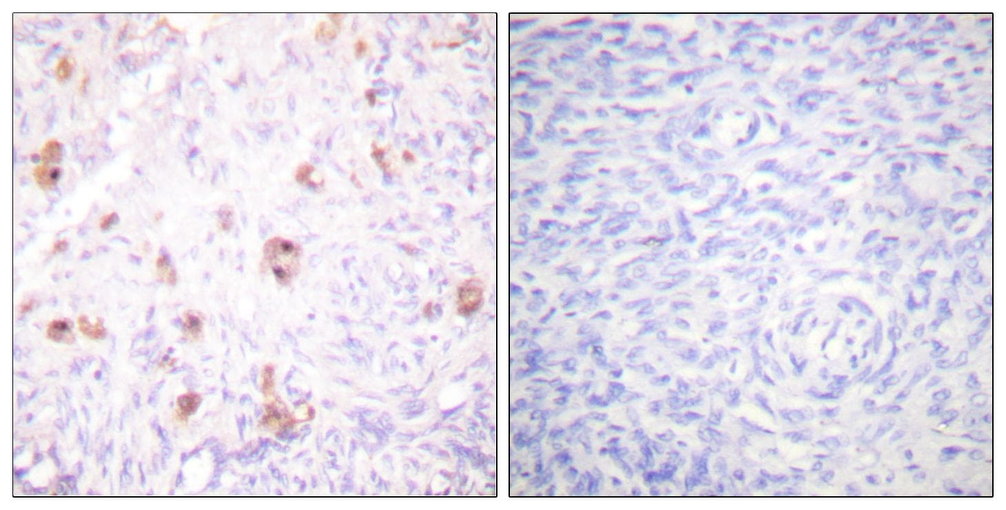 IKBKG / NEMO / IKK Gamma Antibody (phospho-Ser31)
