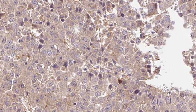 Polyclonal Rabbit anti-Human PTHR / PTHR1 Antibody (IHC, IF, WB)
