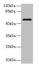 Polyclonal Rabbit anti-Human MAOA / Monoamine Oxidase Antibody (IHC, WB)