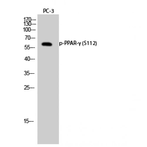 Polyclonal Rabbit anti-Human PPARG / PPAR Gamma Antibody (50-130 aa, WB)