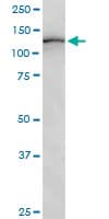 ULK1 Antibody (clone 2H8)
