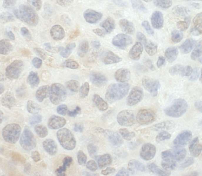SRPK1 Antibody (aa275-325)