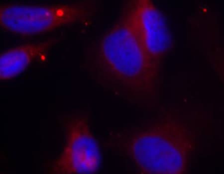 ZAP70 Antibody (phospho-Tyr319)
